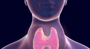Thyroid Disorders