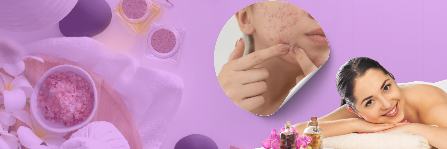 Best Rosacea Treatment