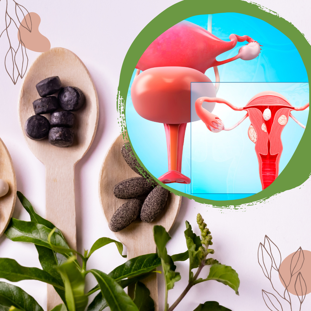 Uterine Fibroids Treatment in Noida
