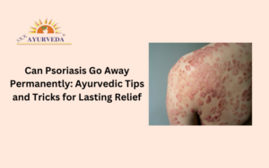psoriasis