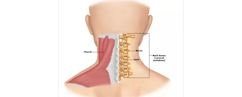 cervical spondylosis 