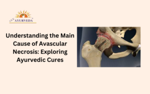 Avascular Necrosis